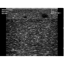 Amazon.co.jp: 超音波ガイド下穿刺トレーニングゲル UGP-GEL 高輝度